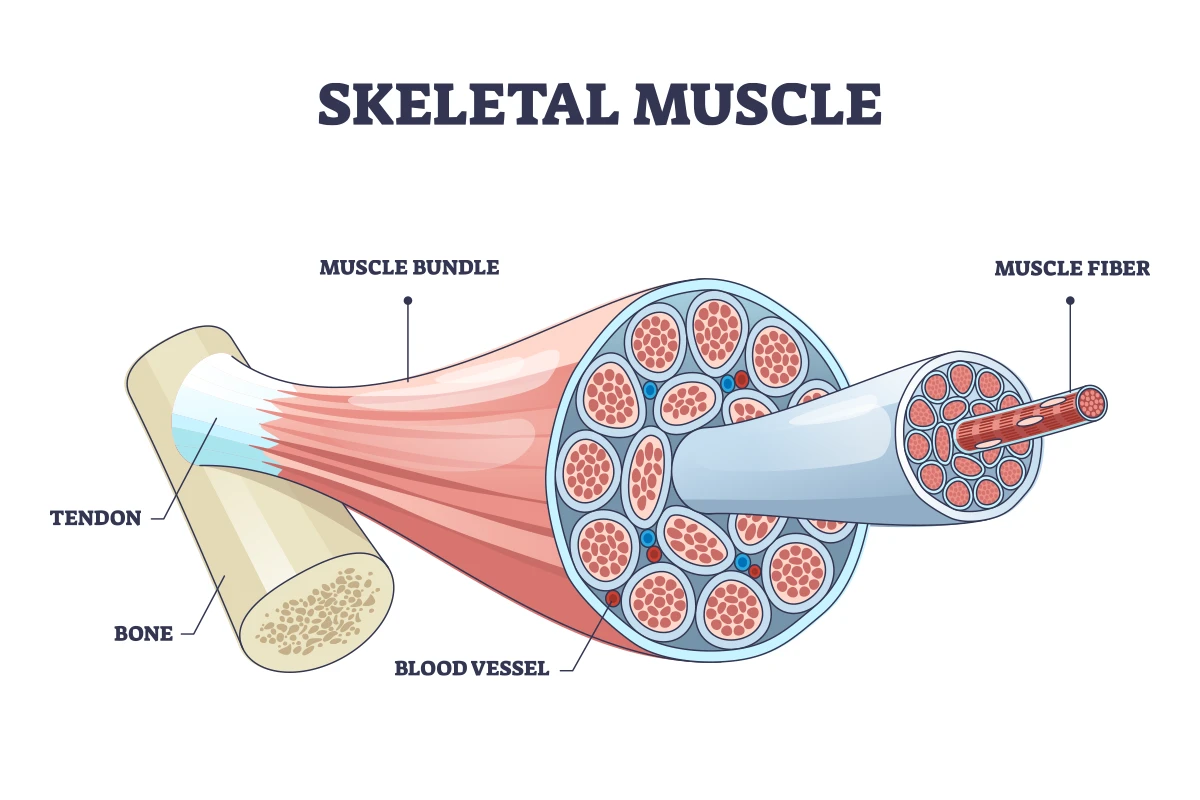 Myopathy
