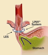 Linx system image