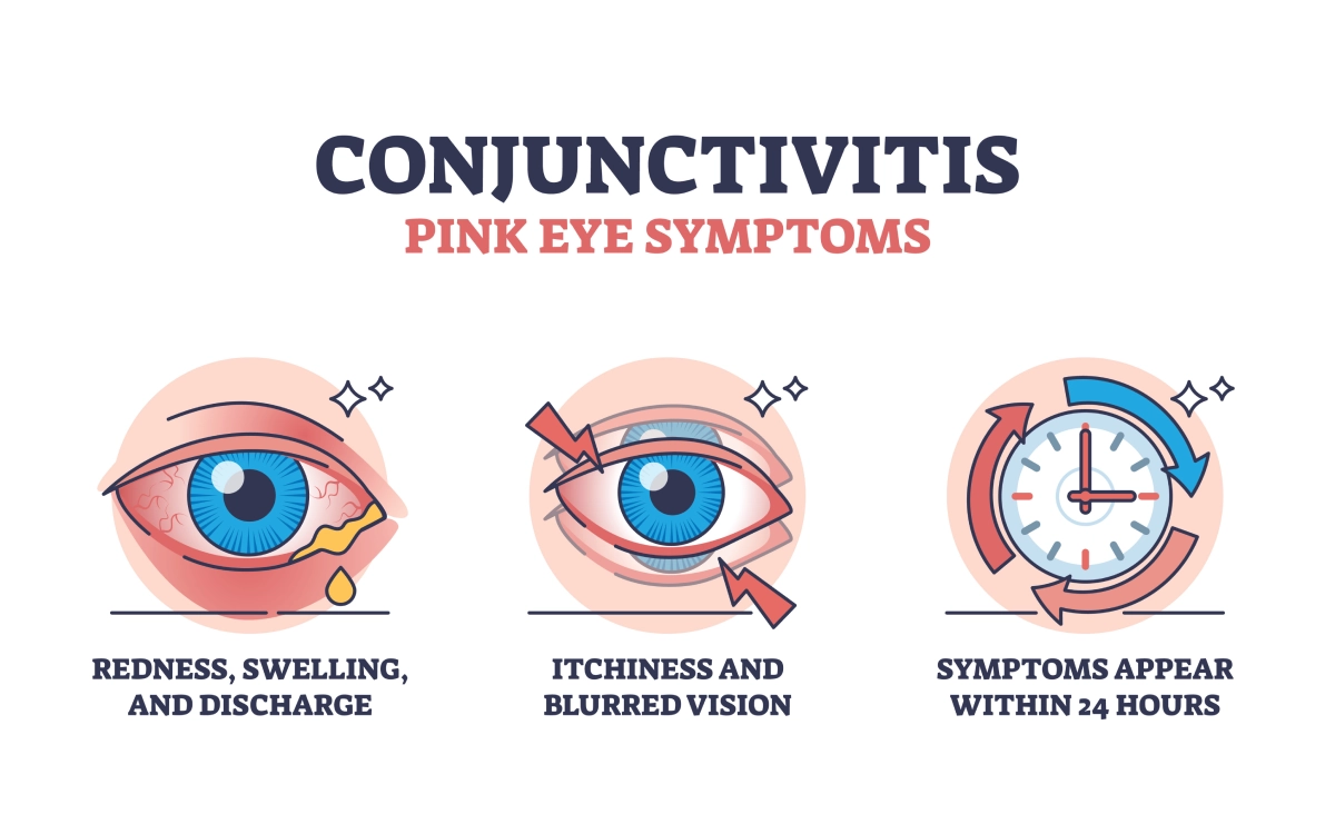 pink-eye-conjunctivitis